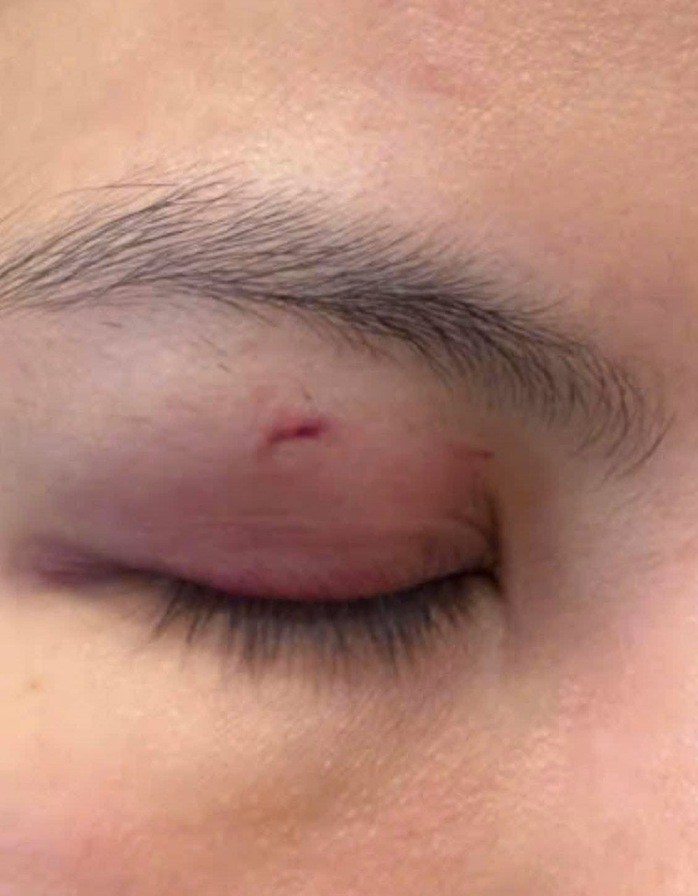 Hình ảnh bác sĩ Nguyễn Linh Thùy, nạn nhân trong câu chuyện bị thương