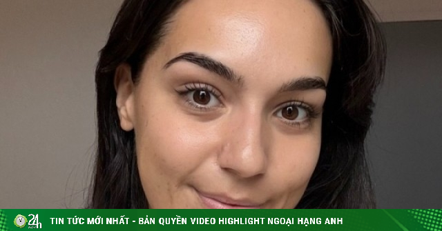 Phát hiện mắc ung thư hạch sau dấu hiệu ngứa dữ dội