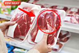 Tin tức sức khỏe - 5 loại thực phẩm cực hại cho tuyến tiền liệt của phái mạnh, nhiều người vẫn vô tư ăn mỗi ngày