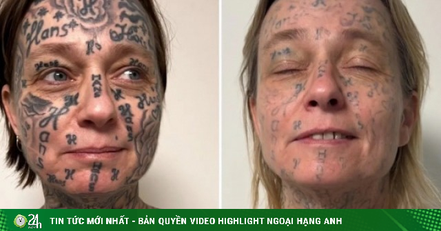 Gã bạn trai cưỡng ép xăm hơn 250 hình lên cơ thể người yêu để đánh dấu chủ quyền
