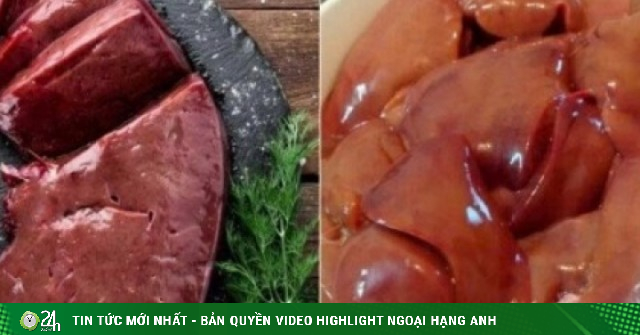 Ăn gan lợn thế nào để không gây hại cho sức khỏe?