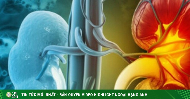 Loại củ quen thuộc đang bán nhiều ở chợ Việt, người bệnh suy thận cần lưu ý khi ăn để ngừa biến chứng