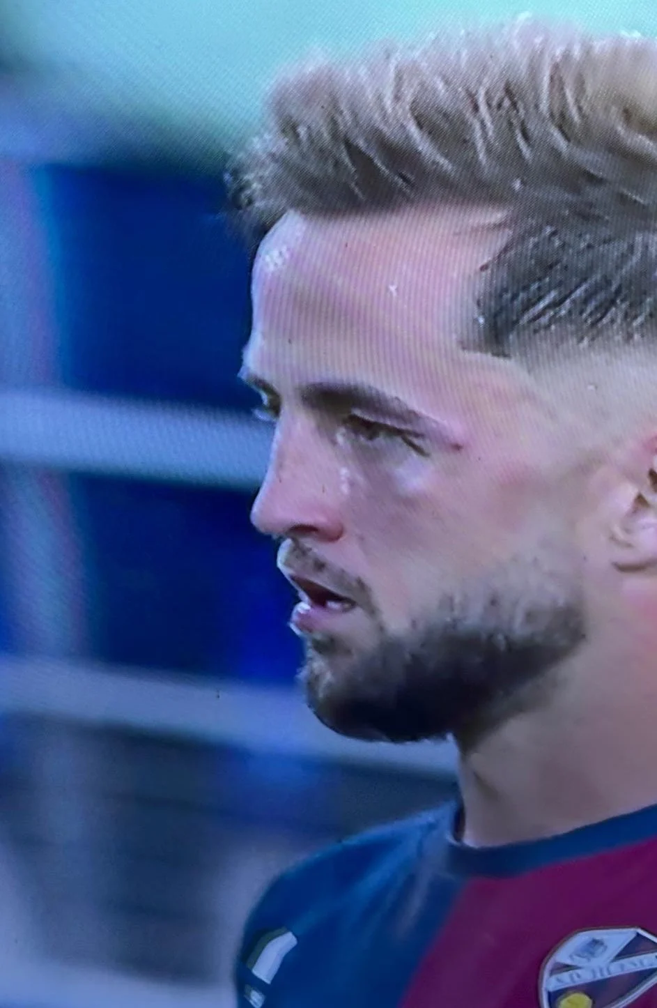 Khuôn mặt của Pulido bị sưng sau khi lĩnh cú đấm của đối thủ