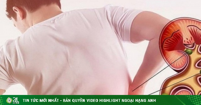 Người đàn ông 35 tuổi mắc suy thận mạn tính từ những món ăn quen thuộc tại hàng quán