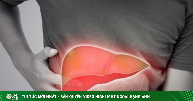 6 dấu hiệu cảnh báo gan nhiễm mỡ, nhiều người hay gặp nhưng lại ngó lơ