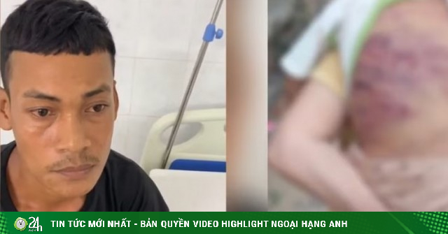 Lời khai của gã cha dượng trong vụ bé trai 2 tuổi bị bạo hành đến nguy kịch