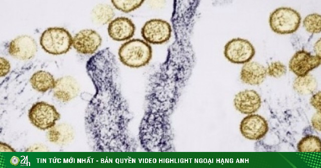 Dịch bệnh bùng phát trên tàu xuyên Đại Tây Dương: Sự nguy hiểm của virus Hanta