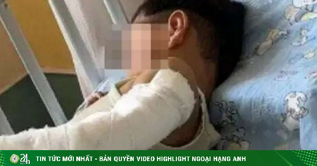Bé trai 4 tuổi rơi từ tầng 11 vì nhớ mẹ, mở cửa sổ chờ bố mẹ về