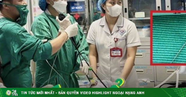 Hiếm gặp: Ăn cá biển, người đàn ông bị lưỡi câu mắc sâu trong thực quản