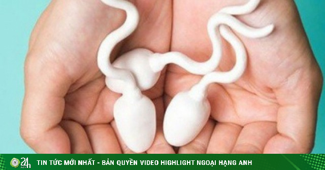 Số lượng tinh trùng của nam giới bao nhiêu là ít?