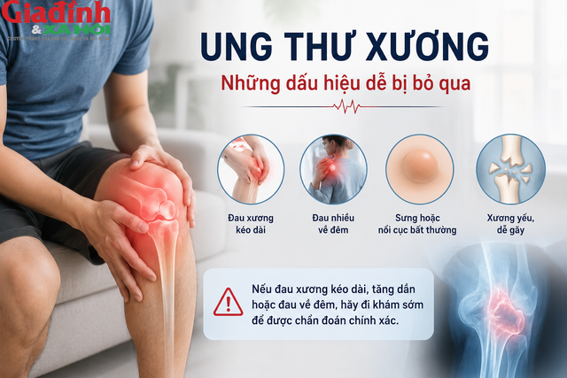 Bác sĩ khuyến cáo người dân không nên chủ quan với tình trạng đau xương kéo dài kèm sưng nề hoặc đau tăng dần theo thời gian.