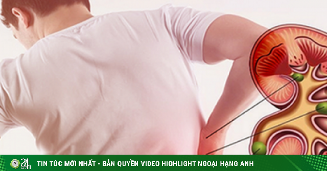 7 thói quen âm thầm làm suy yếu thận, nam giới cần thay đổi sớm