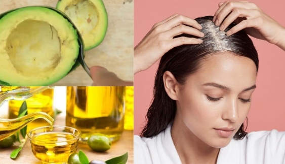 Nhờ chứa c&aacute;c axit b&eacute;o thiết yếu (như omega-3, axit oleic), bơ bổ sung độ ẩm cần thiết, hỗ trợ cải thiện t&igrave;nh trạng so sợi t&oacute;c bị sần s&ugrave;i, kh&ocirc; do thiếu nước.