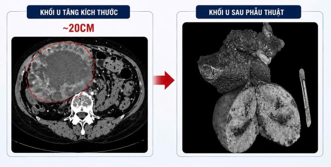 Bệnh viện cung cấp