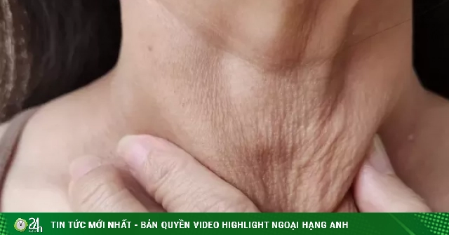 3 vùng da dễ lão hóa nếu bị bỏ quên khi dùng kem chống nắng