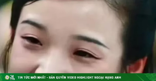 Màn lột xác của 'Lâm Đại Ngọc xấu nhất lịch sử'
