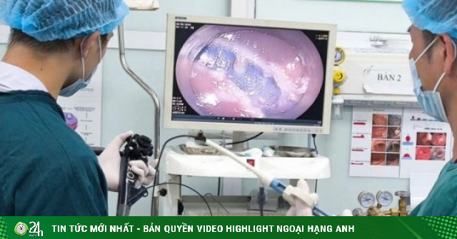 Mệt mỏi, sụt cân sau thời gian dài táo bón, người phụ nữ 48 tuổi nhận kết quả không ngờ