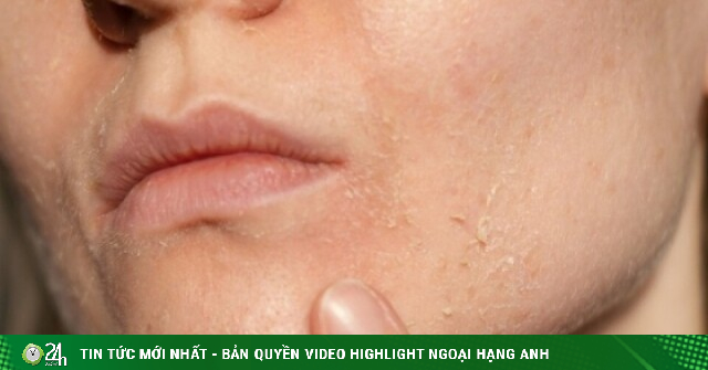 5 thói quen khiến da lão hóa nhanh hơn trong mùa hè