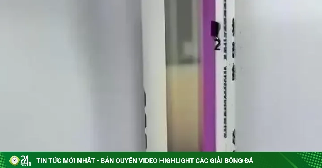 Uống 3-4 cốc trà sữa mỗi ngày, người phụ nữ phải thay huyết tương