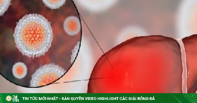 Thanh niên 28 tuổi men gan tăng gấp 70 lần, bác sĩ phát hiện nguyên nhân bất ngờ