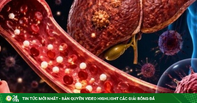 Đường huyết cao, kéo dài liên tục có thể liên quan đến một số bệnh ung thư