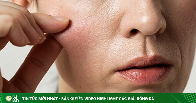 5 thói quen hàng ngày khiến collagen 'bốc hơi' nhanh hơn bạn tưởng