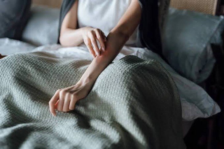 Ngứa da do suy thận thường nghiêm trọng hơn vào ban đêm, làm gián đoạn giấc ngủ, gây mệt mỏi, căng thẳng và ảnh hưởng đến chất lượng cuộc sống.
