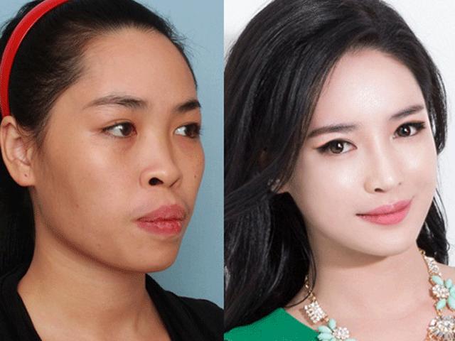 Hot girl Nam Định ước tính ”đập toàn mặt” tốn 1,5 tỷ đồng