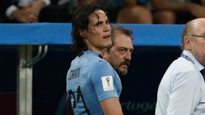 Trực tiếp vòng 1/8 World Cup 2018: Uruguay gặp tổn thất cực lớn - 1