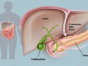 Sức khỏe đời sống - 6 dấu hiệu đã đến lúc bạn cần thải độc gan