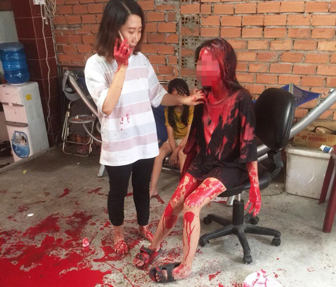 Cô gái 21 tuổi bị tạt sơn khắp người - 1