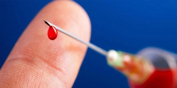 Những cách lây nhiễm HIV “trời ơi đất hỡi” nhất mà ai cũng có nguy cơ - 4