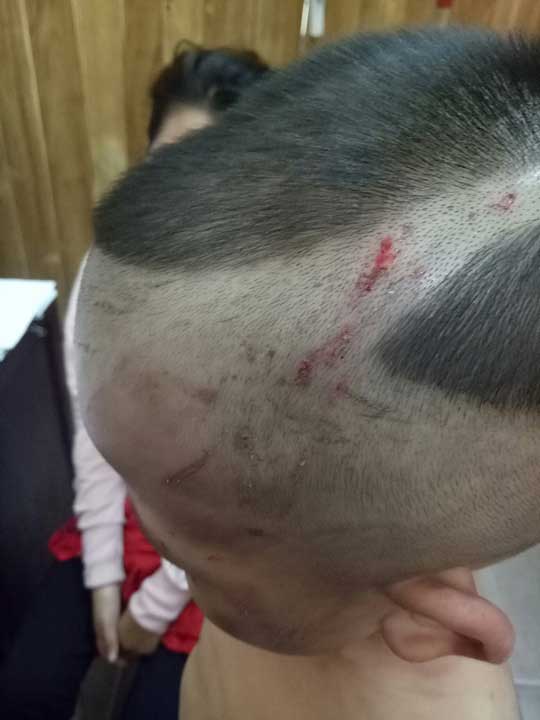 Đã có kết luận thương tích bé trai bị cha dượng đánh dã man ở Phú Quốc - 1