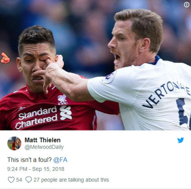 “Móc mắt” Firmino ghê rợn: SAO Tottenham nhận mưa &#34;gạch đá&#34;, Liverpool lo lắng - 3