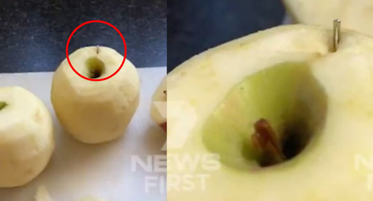 Úc: Tìm thấy cả kim khâu trong quả táo - 1