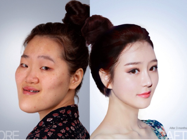Hàn Quốc: Xấu xí là thất bại đời người đến hiện tượng ”100 khuôn mặt trông như 1”
