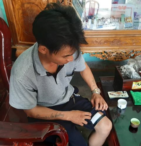 Bảo vệ Phạm Văn Bằng kể lại phút đối mặt với tên cướp và chỉ cho phóng viên vết thương bị bắn.