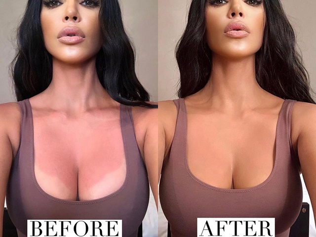 Tại sao Kim Kardashian bị chỉ trích khi make up vùng da cháy nắng?