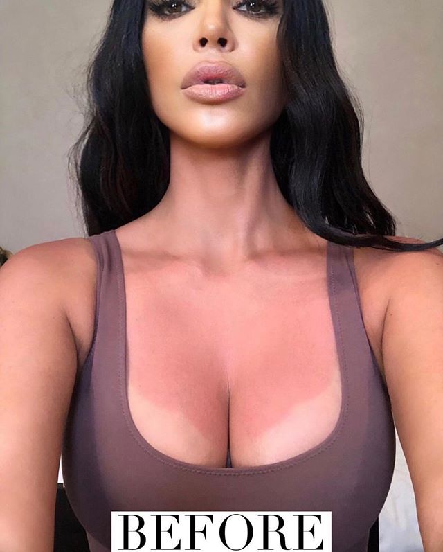 Vùng ngực bị cháy nắng của Kim Kardashian.