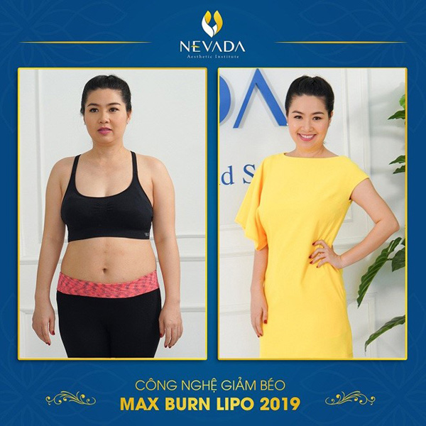 Diễn viên Lê Khánh thành công với công nghệ Max Burn Lipo