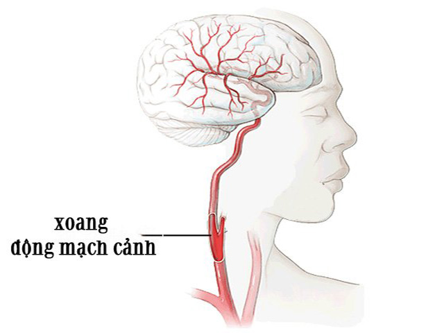 Cô dâu đột tử vì chú rể hôn quá mạnh, 4 huyệt tử nhất định cần phải tránh - 2