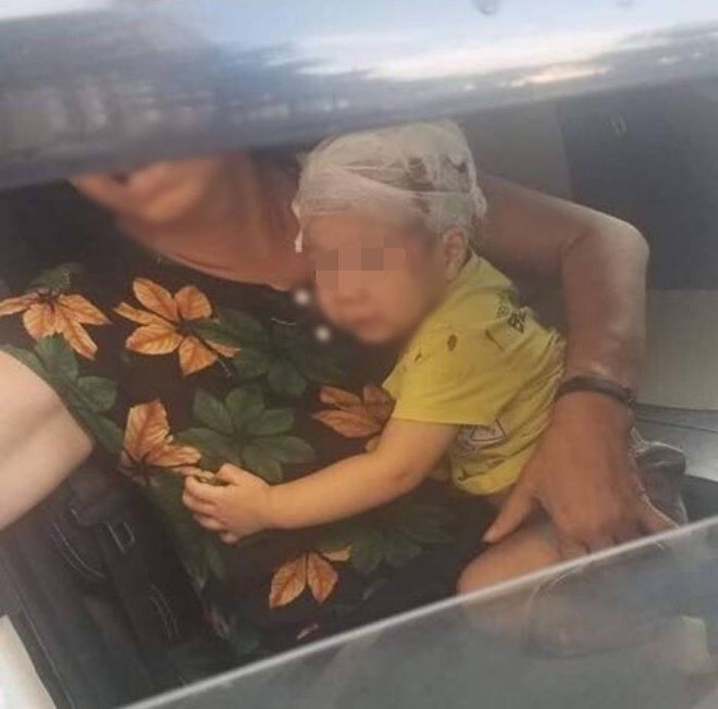 Người nhà đưa bé trai 16 tháng tuổi đi cấp cứu