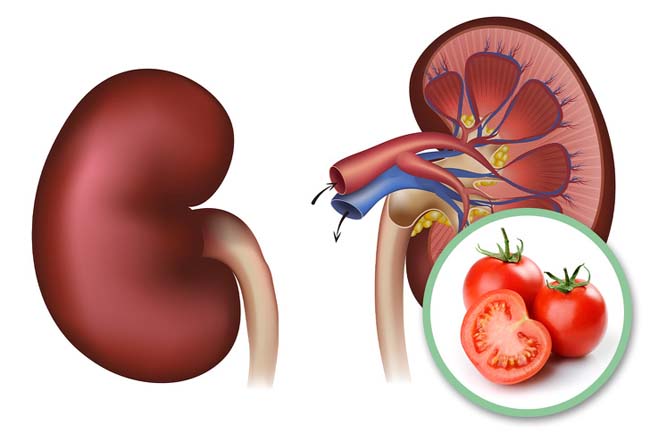 Những người tuyệt đối không nên ăn cà chua nếu không muốn rước bệnh vào người - 3