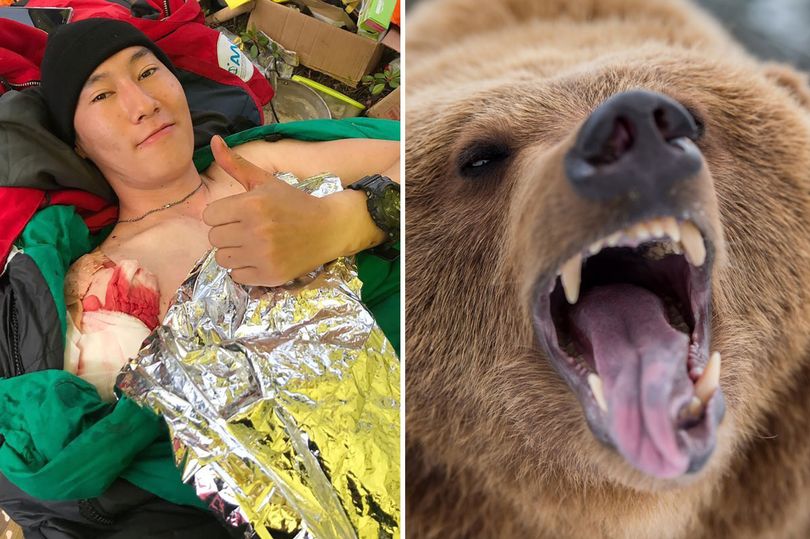 Nikolay Maksimov bị con gấu tấn công khi ngủ qua đêm trong lều trại gần bìa rừng
