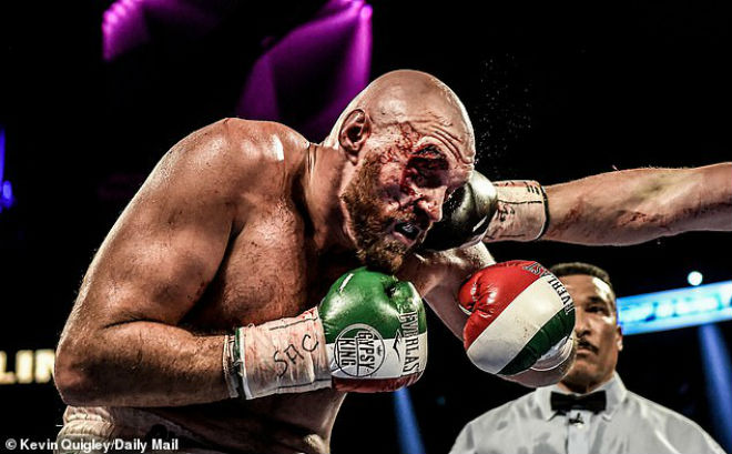 Vết thương nghiêm trọng ở mắt của Tyson Fury