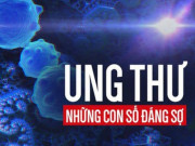 Sức khỏe đời sống - Những bệnh ung thư nào đứng đầu ở Việt Nam?