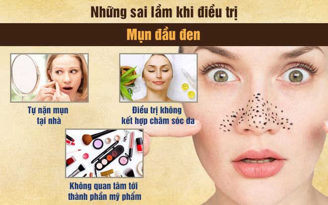 Trị mụn đầu đen: Những sai lầm thường gặp và cách xử lý hiệu quả - 2