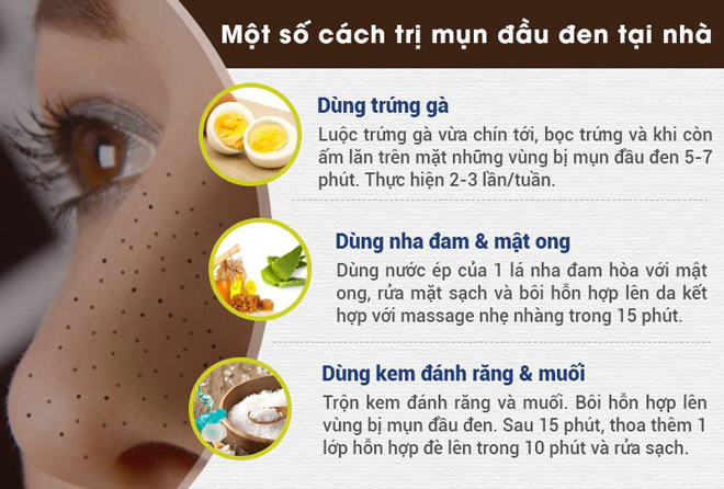 Trị mụn đầu đen: Những sai lầm thường gặp và cách xử lý hiệu quả - 3