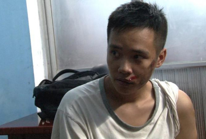 Đối tượng cướp giật Phạm Bá Quang Hiếu với khuôn mặt thương tích, trầy xước do gặp nạn khi thực hiện một phi vụ cướp điện thoại người đi đường tại Huế.