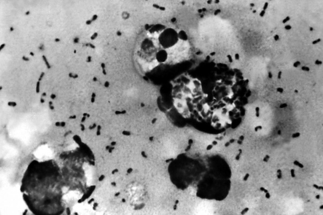 Hình ảnh vi khuẩn Yersinia pestis gây ra bệnh dịch hạch. Ảnh: Shutterstock